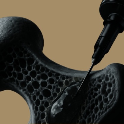 Vertebroplasty & Pain Injections illustration