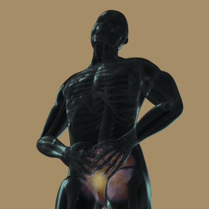 Prostate Artery Embolization illustration